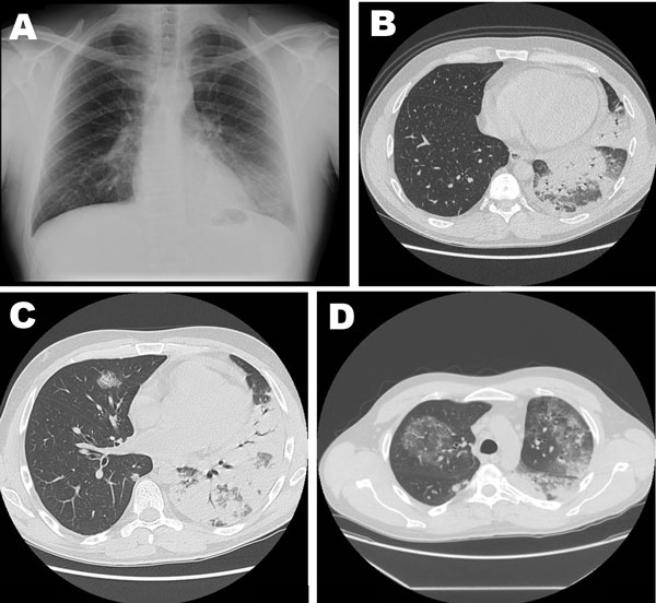 Man with Legionnaires' disease often visited mainland