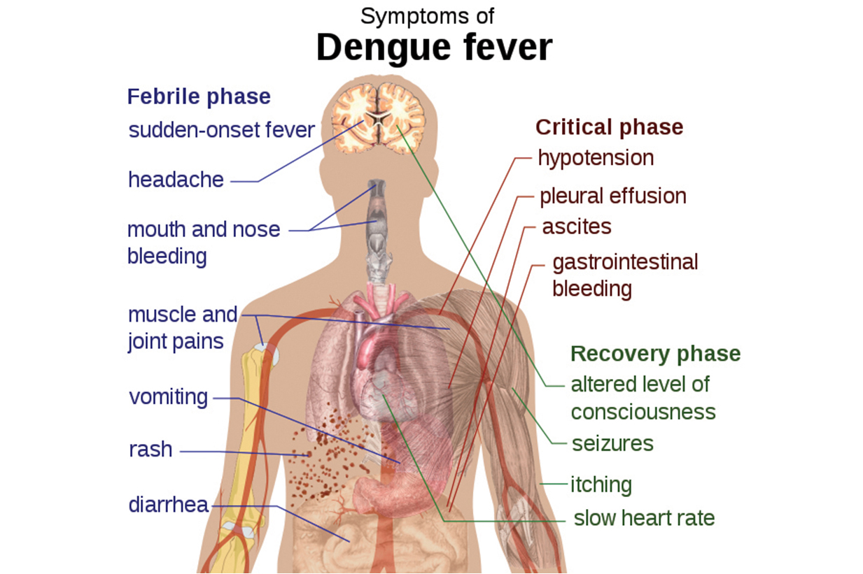 East Timor dengue surge nears 2,000