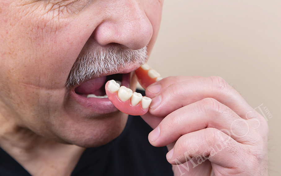 Govt to lower age for denture pilot programme: SSM