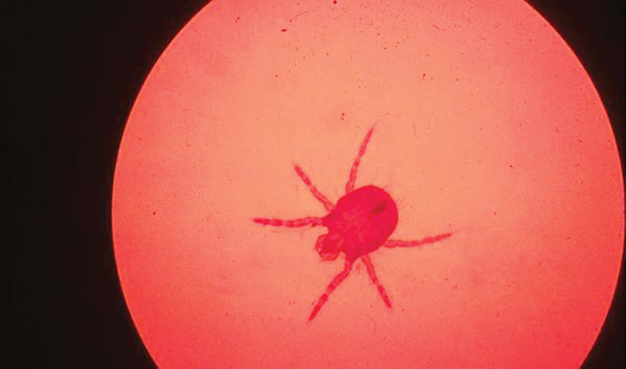 Landscape gardener diagnosed with scrub typhus: SSM