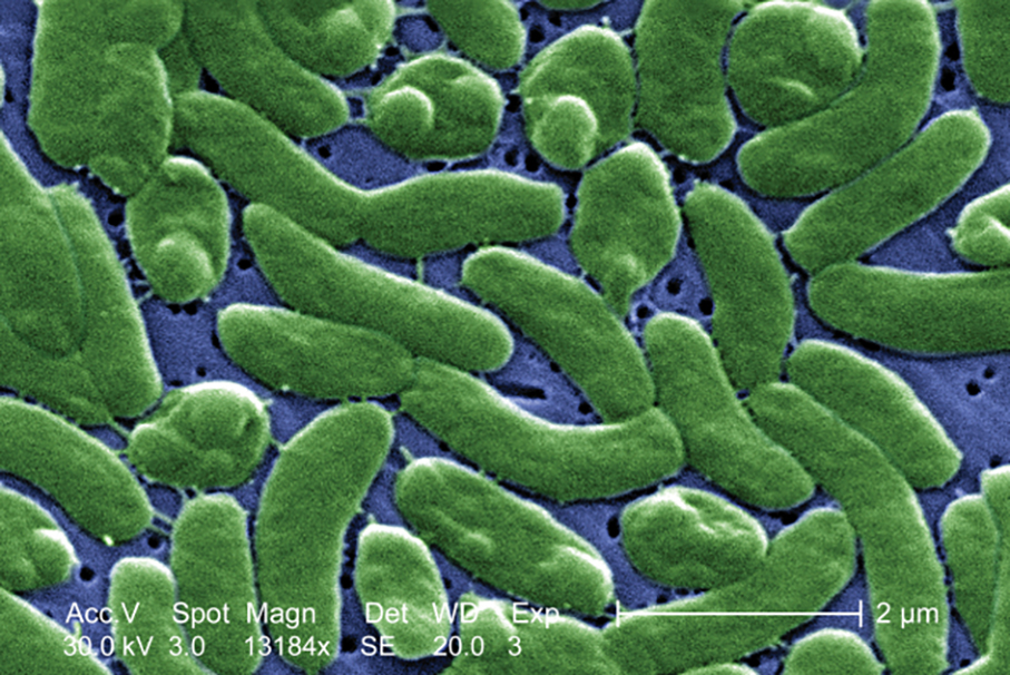 SSM receives report of vibrio vulnificus infection