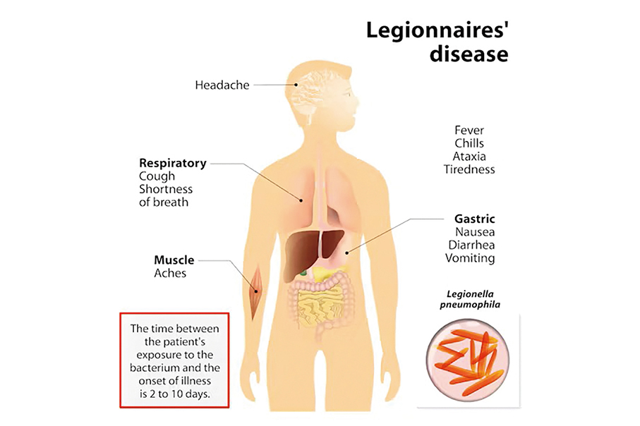 Elderly patient tests positive for Legionnaires’ disease in Macau 