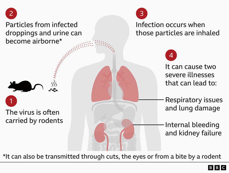 Health Bureau urges travellers to remain vigilant over hantavirus cases 